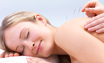 $19 for a One-Hour Acupuncture  Consultation & Treatment incl. 50% off Your Next Treatment (value up to $97.50)