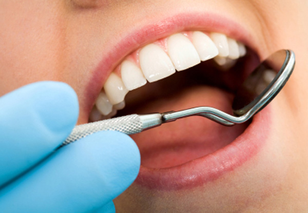 $89 for a Dentist Exam, Full Mouth X-Rays, Scale & Clean (value up to $160)