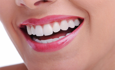 $49 for a Dental Check-Up incl. X-Rays & a $40 Return Voucher To Be Used Towards Further Treatment, or $149 for One Hour of In-House Professional Teeth Whitening (value up to $500)