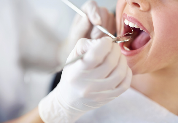 $95 for a Dental Examination, Scale & Polish & Two X-Rays (value up to $140)