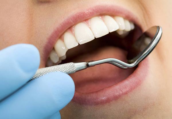 $25 for a Full Mouth Examination & Two X-Rays, $59 to incl. One Professional Clean, $129 to incl. One Surface White Filling or $169 to incl. Two Surface Fillings, Scale & Polish - Five Auckland Locations (value up to $249)