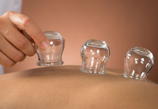 From $10 for Traditional Chinese Cupping Treatments (value up to $80)