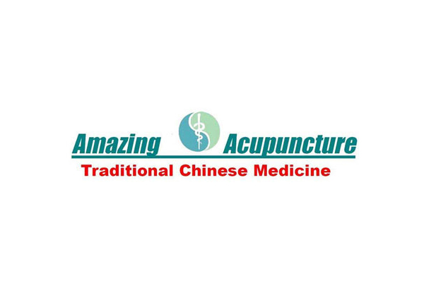 $32 for a One-Hour Acupuncture Session - Three Christchurch Locations (value up to $65)