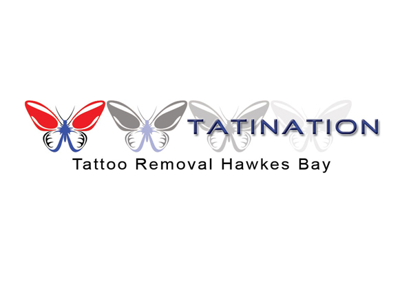 $99 for Four Tattoo Removal Sessions for Areas up to 132mm² (value up to $700)