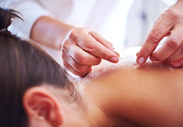 $36 for Massage and Acupuncture Treatments or $36 for Your Choice of Three Sessions – Six Options (value up to $255)