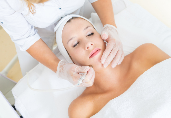 Microdermabrasion Skin Treatment with Eyebrow Tidy - Option for Vital C Anti-Oxidant Facial