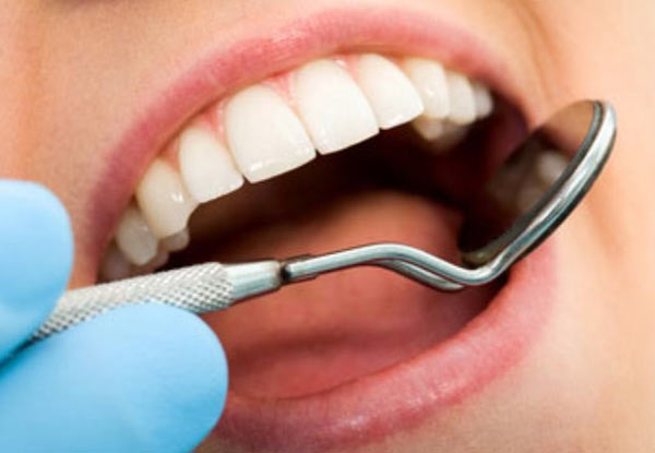 $89 for a Full Dental Exam, Two Digital X-Rays, Clean, Polish & a $30 Voucher Towards Your Next Treatment – Two Auckland Locations (value up to $175)