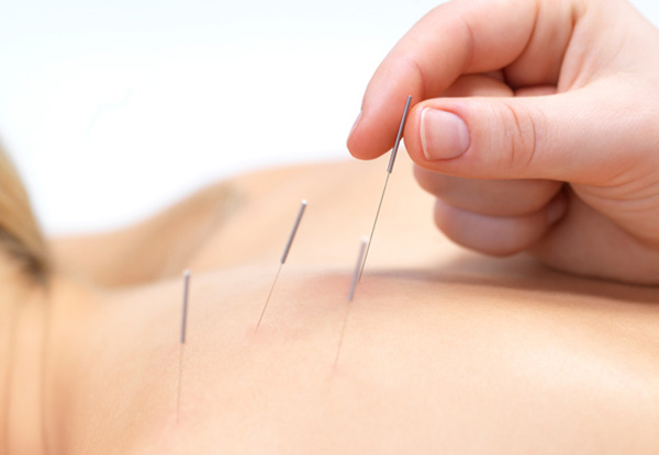 From $49 for a 75-Minute Initial Consultation & Acupuncture Treatment (value up to $190)