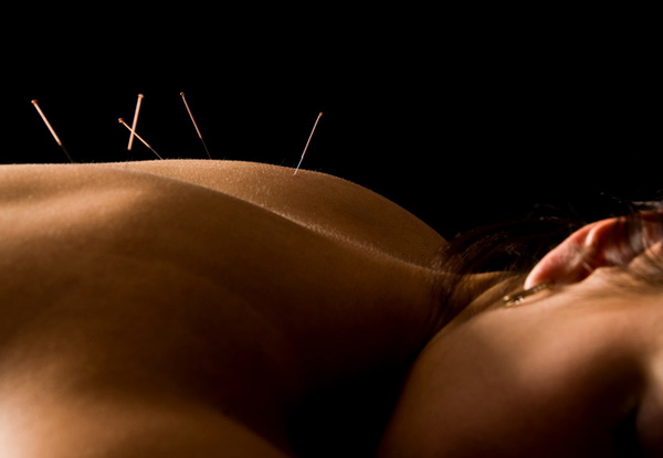 $49 for a 60-Minute Massage or $59  for a 75-Minute Acupuncture & Massage – Options for Three or Six Sessions (value up to $680)
