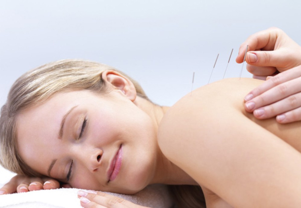 $35 for a One-Hour Acupuncture Session or $90 for Three Sessions (value up to $180)