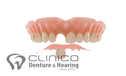 $450 for a Partial Denture (Up to Four Teeth) incl. Examination & All Appointments - Seven Locations (value up to $1,150)