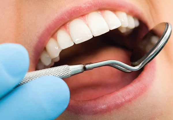 $69 for a Full Dental Exam, Check Up & Clean (value up to $200)