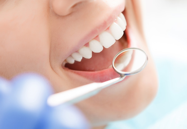 $125 for a Single Tooth Filling incl. a Consultation, X-Ray & Post Op Care (value up to $250)