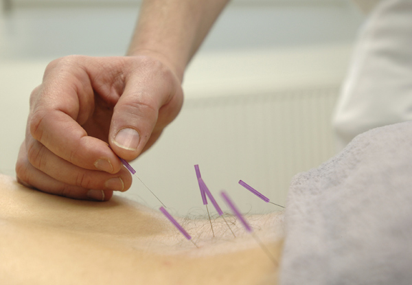 $32 for a One-Hour Acupuncture Session - Three Christchurch Locations (value up to $65)