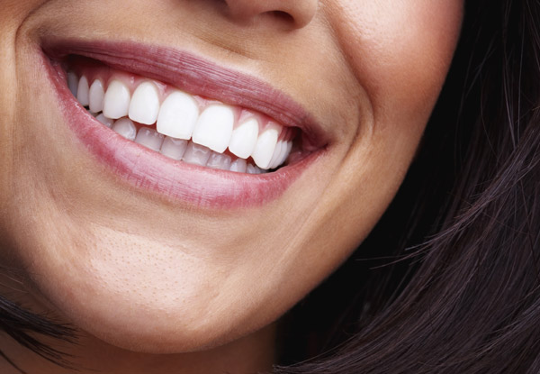 $59 for a Dental Exam, Two X-Rays & $30 Voucher (value up to $140)