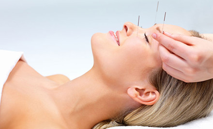 $40 for a One-Hour Acupuncture Session or $105 for Three One-Hour Acupuncture Sessions (value up to $240)