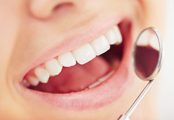 $99 for a Full Dental Exam, Check Up & Clean incl. $50 return voucher (value up to $250)