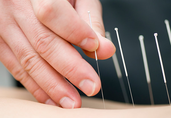 $29 for a One-Hour Acupuncture or Traditional Chinese Massage Session or $39 for a 90-Minute Session (value up to $105)