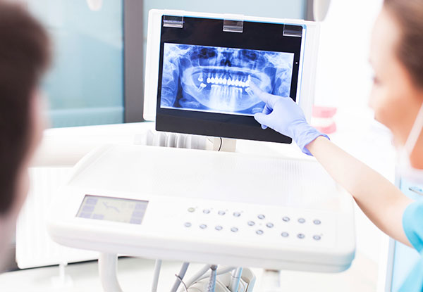 $55 for a Dental Exam & X-Ray (value up to $109)