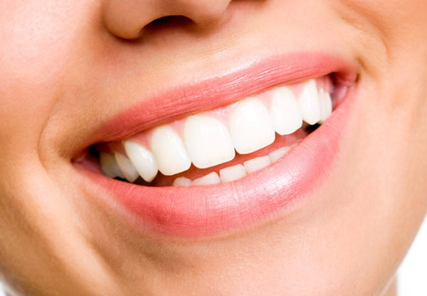 $49 for a Full Dental Exam incl. X-Rays & $40 Return Voucher (value up to $135)