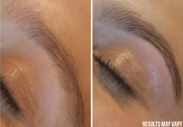 $32 for an Eyebrow Revolution Treatment & a $15 Return Voucher (value up to $65)