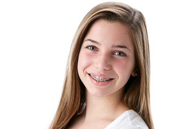 $99 for a $2,000 Voucher Towards Braces