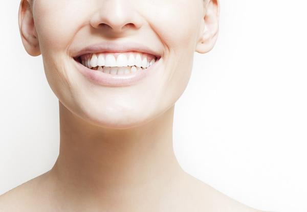 $89 for a 45-Minute Dental Hygienist Appointment incl. Two X-Rays (value up to $150)