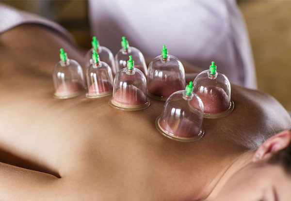 $19 for One 30-Minute Cupping Therapy Session – Options Available for Five or Ten Sessions (value up to $380)