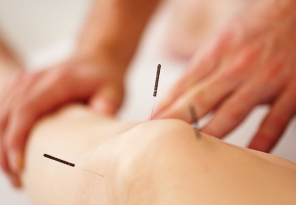 $35 for One-Hour Traditional Acupuncture or $70 for 1.5-Hour Cosmetic Acupuncture Session