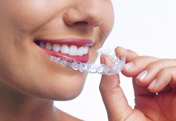 Deposit for a Complete Invisalign® Teeth Straightening Package incl. All Appointments, Clear Aligners, X-Rays & 3D Digital Preview - Entire Package is $7,400 with Finance Options Available