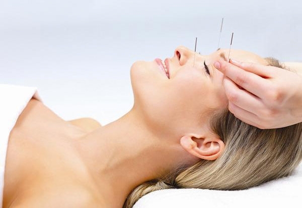 $20 for Two Acupuncture Sessions incl. Consultation