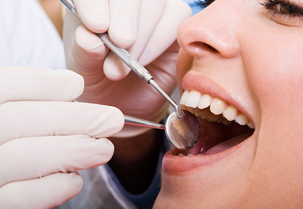 $79 for a Dental Exam, Two X-Rays & Scale & Polish (value up to $170)