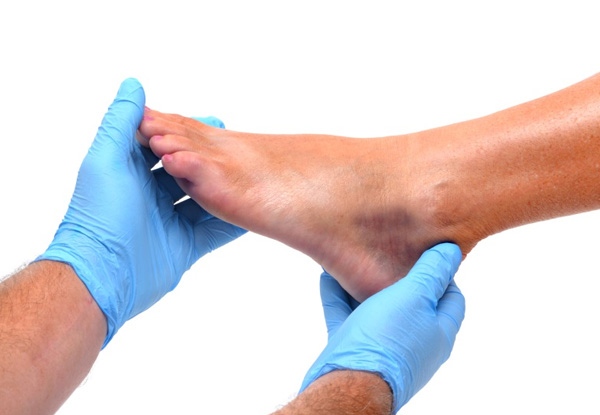 $30 for a 30-Minute Consultation with a Registered Podiatrist & $20 Return Voucher