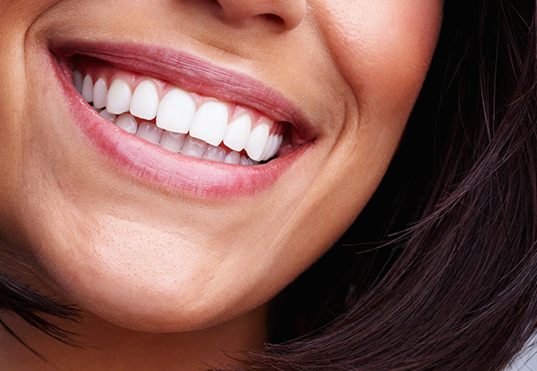 $21 for Dental Exam & X-Ray (value up to $50)