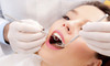 Full Dental Check, X-Rays, Advice & Clean