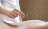 60-Minute Acupuncture Treatment