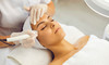 Five Radio Frequency Skin Tightening Sessions