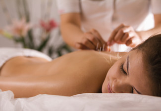 60-Minute Acupuncture Treatment - Option for Massage, Cupping, Fertility or ACC-Injury Treatment