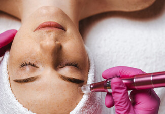 Single Microneedling Session incl. Extractions, Eyebrow Threading/Shaping, Numbing, Sheet Mask, LED Light Therapy & Foot Massage