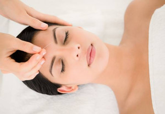 60-Minute Pimple or Wrinkle Acupuncture Session - Option for Three-Sessions