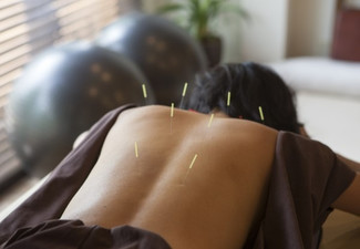 One-Hour Acupuncture & Cupping Treatment - Options for One-Hour Acupuncture Treatments incl. Massage, Guasha, Pain Relief, Women's & Men's Health, Mental Wellbeing & Any Three Sessions