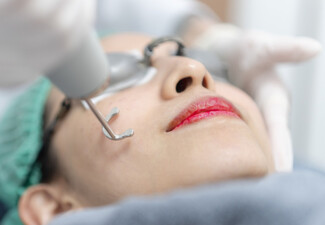 One Session of Advanced Pico Laser Rejuvenation Treatment - Option for Three Sessions