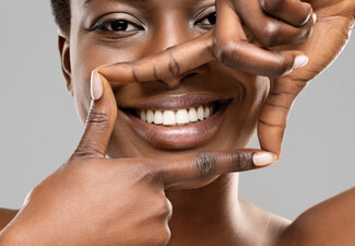 60-Minute Triple Treatment Teeth Whitening at Lush Smiles Tauranga