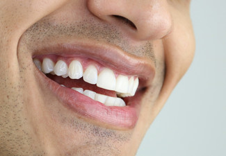 Express Teeth Whitening Treatment for One incl. One Whitening Pen - Valid from January 1st 2025