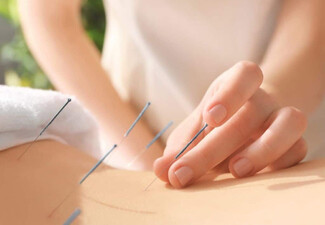 45-Minute Acupuncture Treatment - Choose from Six Options
