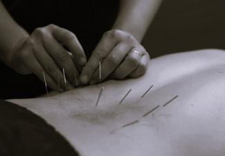 60-Minute Comprehensive Treatment Session at Acupuncture & Health Centre