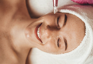 Single Microneedling Session for One