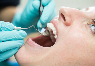 Dental Check-Up Package Incl. Dental Examination, Clean & Polish & Two Bitewing X-Rays