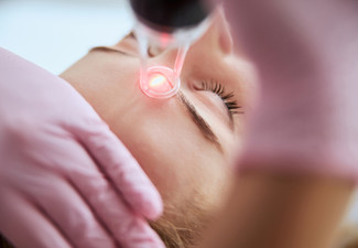 Single Laser Facial Session for One