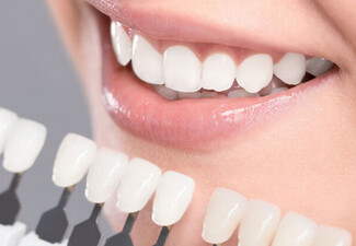 90-Minute Ultimate Teeth Whitening Session at Lovelysmiles Wellington CBD